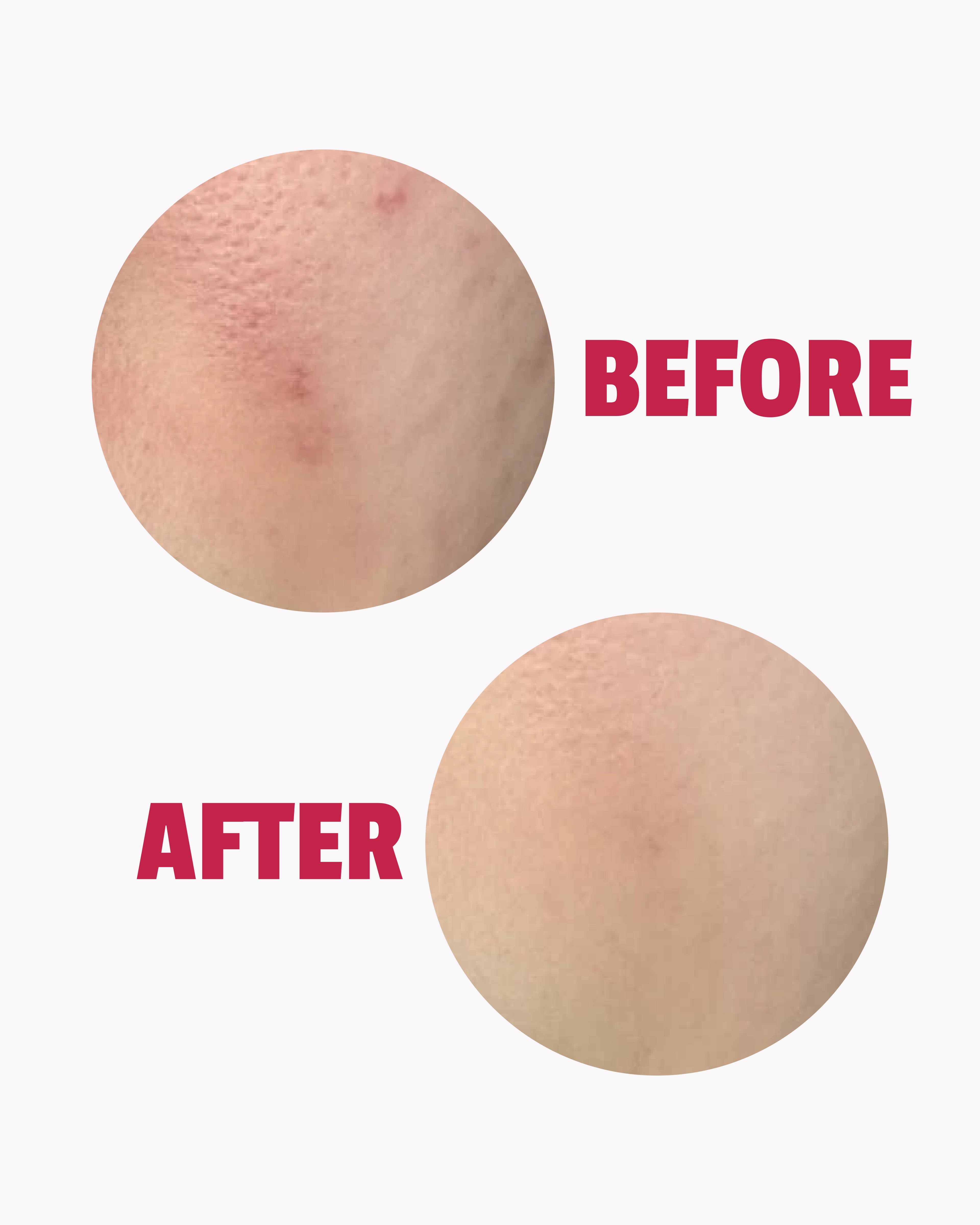 Clarifying Serum 2% SA, 3% niacinamide
